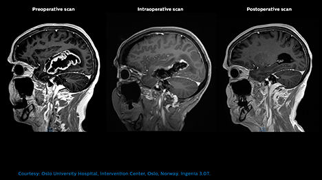 magnetic resonance OR WEB 06 Intraoperative